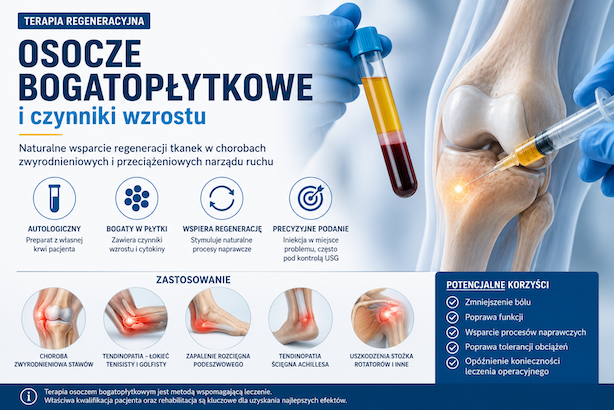 Terapia osoczem bogatopłytkowym